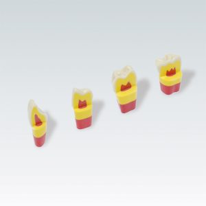 Dientes dentina-pulpa ANA-4