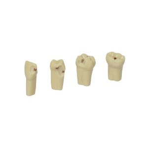 Dientes con caries AG-3